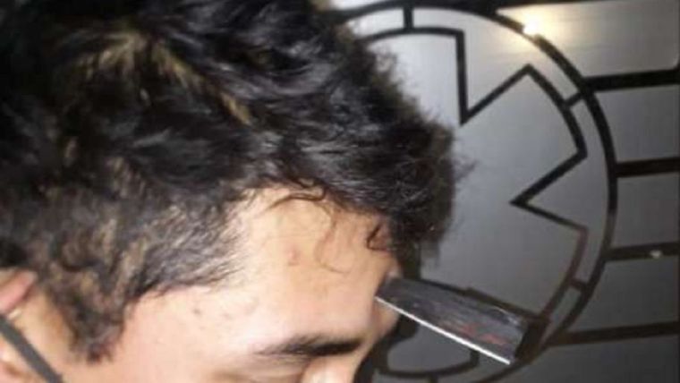 El hombre con el cuchillo en la frente tras la agresión de sus vecinos