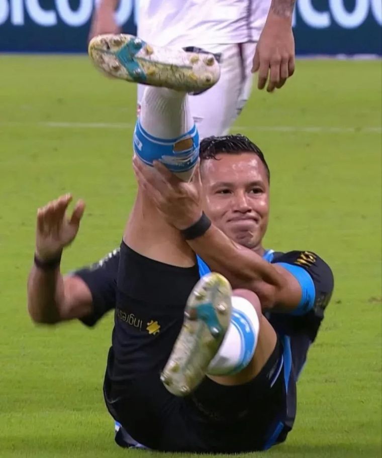 Marlon, defensor del Gremio de Porto Alegre, sufrió una escalofriante lesión en su tobillo.