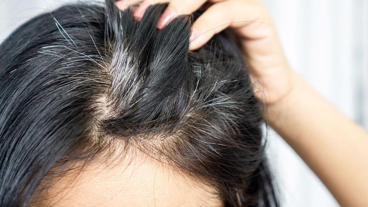 CANAS A media que el cabello pierde la melanina, van apareciendo canas Foto: Shutterstock