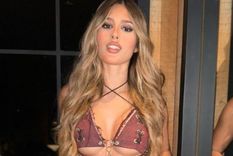 Julieta Poggio, de Gran Hermano, mostró su nuevo retoque estético La ex participante dle reality compartió su cambio de aspecto en Instagram Foto: @poggiojulieta