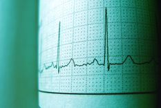 inflacion, regulacion de las prepagas y copagos: una bomba de tiempo