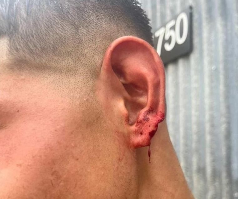 Violenta gresca en Rafaela: un ex jugador de Independiente quedó en el centro de la polémica. Violenta gresca en Rafaela: un ex jugador de Independiente quedó en el centro de la polémica.