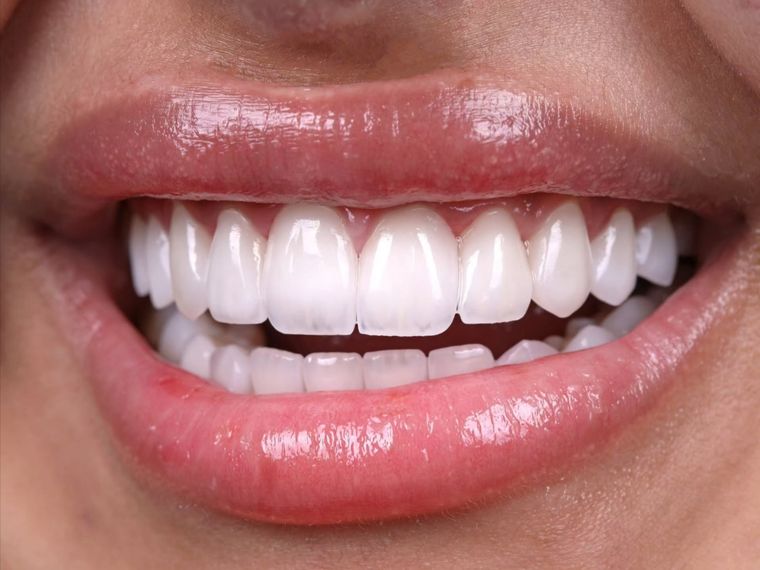Hay que tener cuidado con los productos para los dientes. Fuente: Shuttertstock. Hay que tener cuidado con los productos para los dientes. Fuente: Shuttertstock.