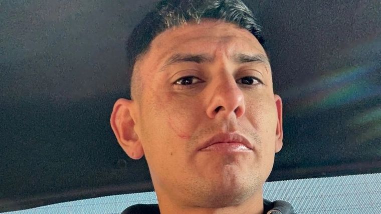 Orihuela mostró cómo quedó su rostro luego del forcejeo con los policías. Orihuela mostró cómo quedó su rostro luego del forcejeo con los policías.