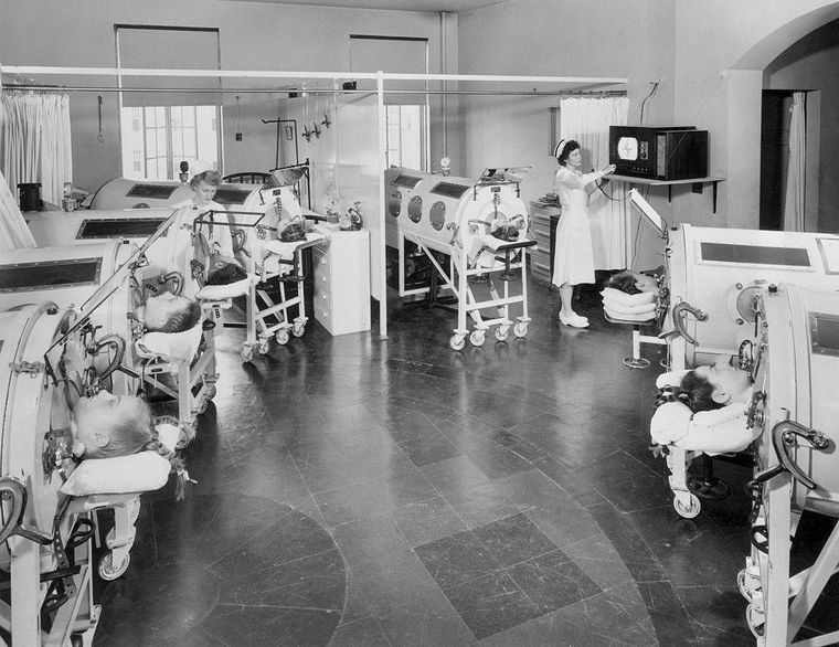 Los niños afectados con polio quedaban confinados a los llamados "pulmones de acero"