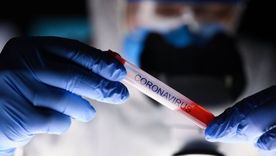 Entender el comportamiento del virus es clave para combatirlo.