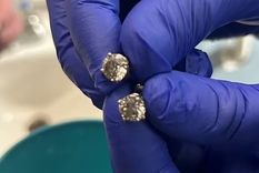 Los aros que se robó y tragó el ladrón. Foto: Departamento Policial de Orlando Los aros que se robó y tragó el ladrón. Foto: Departamento Policial de Orlando