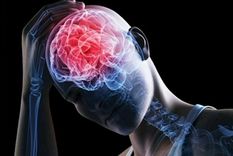 Los tumores cerebrales representan un desafío significativo debido a su diversidad y la variabilidad en su comportamiento y efectos. Foto: MDZ