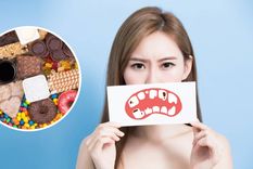 Los alimentos que atentan contra tus dientes (Shutterstock).