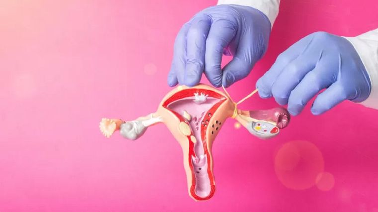 La esterilización femenina también se conoce como ligadura de trompas. Foto: GETTY IMAGES