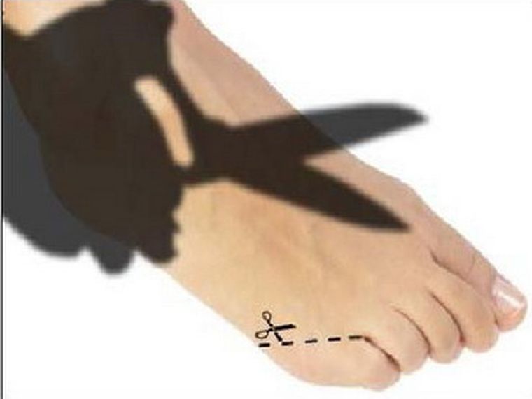 Muchos quieren embellecer sus pies. Foto: Gentileza Cracked