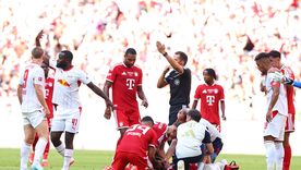 Jamal Musiala se desplomó en Bayern Múnich-Leipzig y generó preocupación en el mundo del fútbol. Jamal Musiala se desplomó en Bayern Múnich-Leipzig y generó preocupación en el mundo del fútbol.
