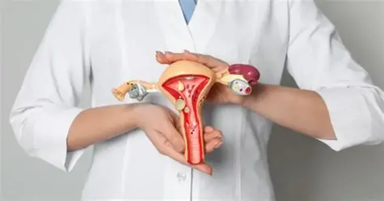 La endometriosis puede estar asociada a dificultades para lograr un embarazo. La endometriosis puede estar asociada a dificultades para lograr un embarazo.