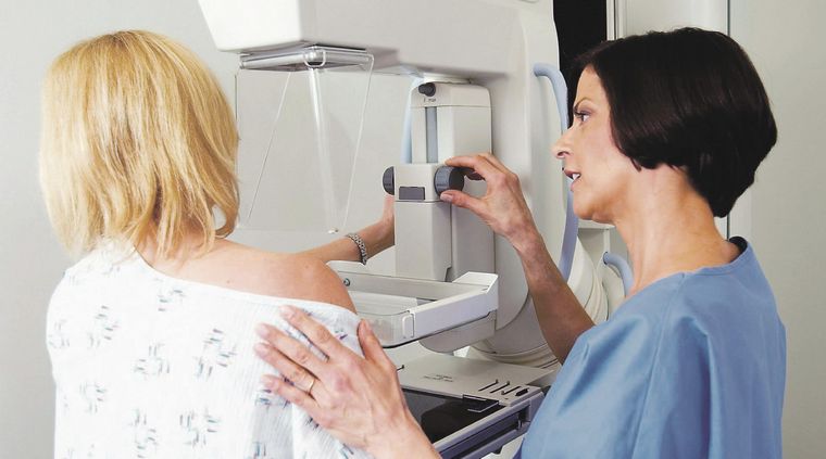 La mamografía es un estudio de imagen de las dos mamas Foto: Web