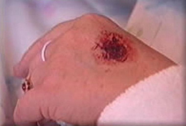 La mujer asegura tener los estigmas de Jesús. Foto: web