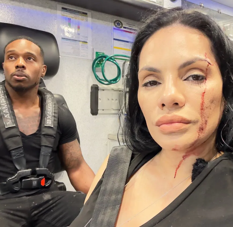 El impactante accidente ocurrió mientras la pareja grababa un programa gastronómico. La camioneta atravesó la vidriera y los golpeó de lleno. El impactante accidente ocurrió mientras la pareja grababa un programa gastronómico. La camioneta atravesó la vidriera y los golpeó de lleno.