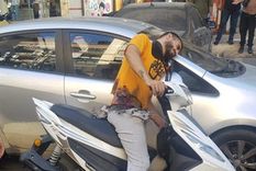 Uno de los heridos en Líbano tras explotar el beeper en su cintura Foto: X