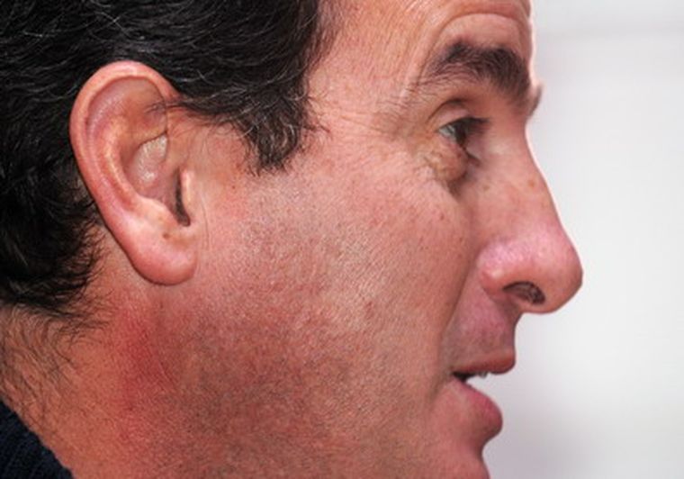 Foto: Nacho Gaffuri / MDZ