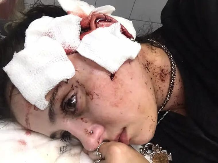 Así dejaron a la joven trabajadora Foto: Facebook: Agustina Tramontana