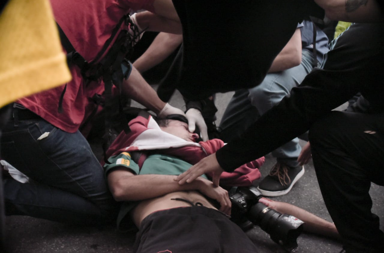 Preocupación por la salud de Pablo Grillo Foto: X