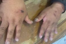 A partir de la inspección en sus manos, se remitieron muestras tomadas debajo de las uñas del acusado para ser cotejadas con el ADN de las víctimas.