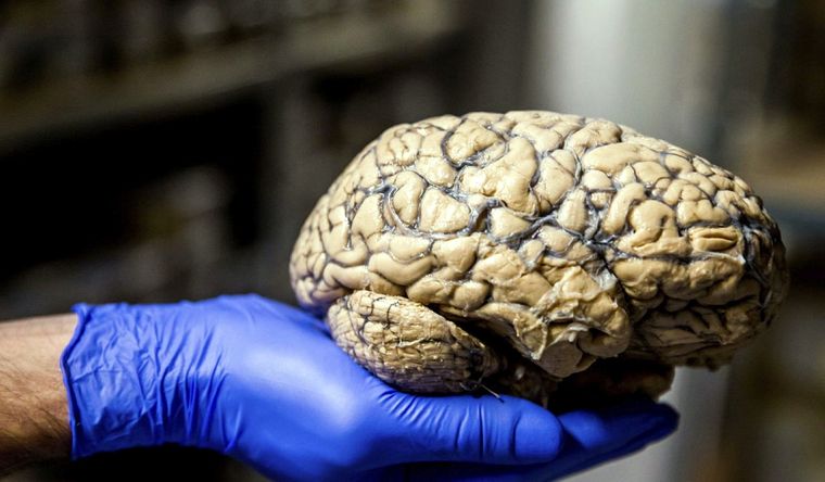 El cerebro humano, fuente inagotable de misterios.