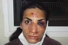 Así quedó la joven trans tras la paliza que le dio un grupo de mujeres