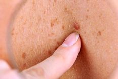 a que hora conviene tomar sol