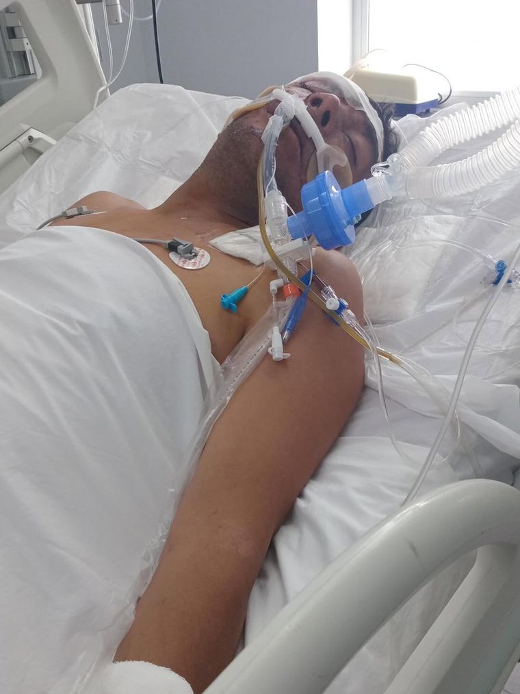 El ciclista mendocino pelea por su vida tras su accidente en San Juan. El ciclista mendocino pelea por su vida tras su accidente en San Juan.