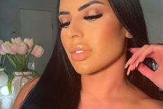 Evelyn Beltrán decidió quitarse el relleno que tenía en sus labios.