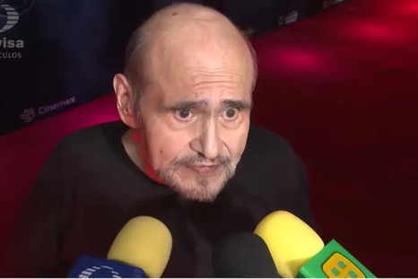 Qué le pasó a Edgar Vivar. / Captura TELEVISA Qué le pasó a Edgar Vivar. / Captura TELEVISA