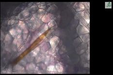 que ocurre bajo la piel cuando nos pica un mosquito