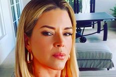 Alicia Machado revela que sufre una dolorosa enfermedad