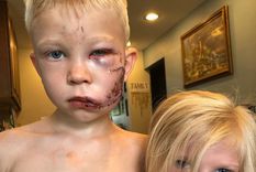 el nino de seis anos que conmovio al mundo fue nombrado campeon honorario del cmb