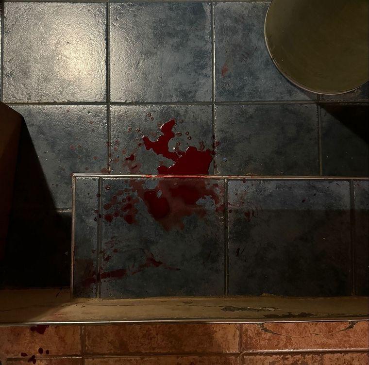 Una familia fue brutalmente golpeada en el barrio Huerto del Sol de Luján de Cuyo Foto: Emilce Vargas Ferrara/MDZ