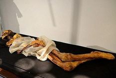 la evidencia mas antigua de cancer de mama