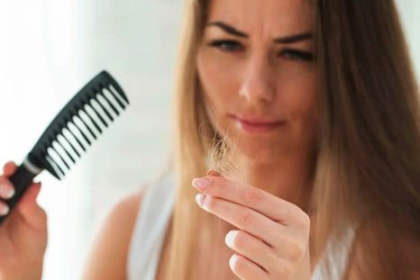 Solo con dos ingredientes caseros: Detén la caída del cabello por completo Foto: Shutterstock