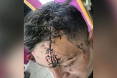 El joven atacado habría sido victíma de una viuda negra en la localidad de Ushuaia.