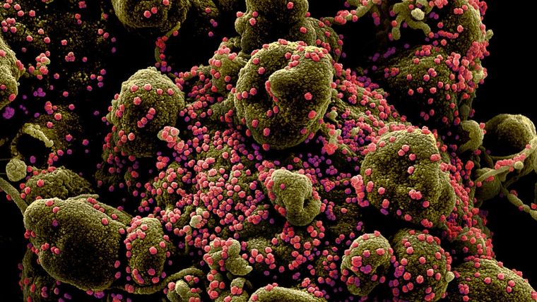 Representación gráfica por ordenador de una célula infectada de covid-19