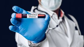 El hantavirus es una enfermedad viral. El hantavirus es una enfermedad viral.