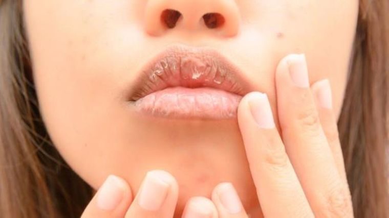 Hidrata tus labios con esta fórmula casera Foto: Shutterstock
