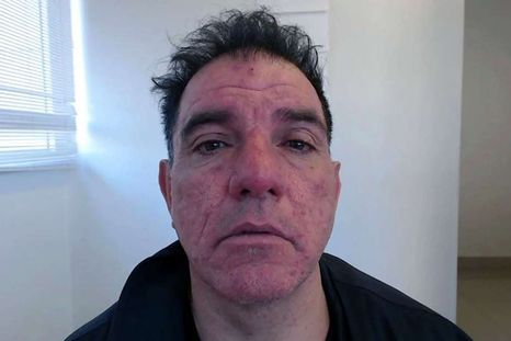El hombre dejó a la mujer con severas heridas. Al ser trasladada al hospital, murió