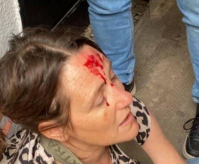 Una preceptora resultó herida luego de intentar separar a los jóvenes. Una preceptora resultó herida luego de intentar separar a los jóvenes.