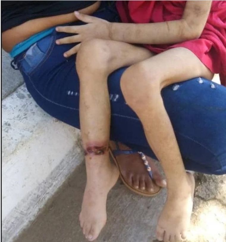 Las heridas en la pierna muestran el maltrato al que era sometida