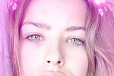 ¿la china suarez se puso botox en los labios?