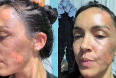 Así quedó la mujer tras ser atacada.