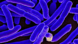 La bacteria con forma de bastón es conocida por causar estragos, pero hay cepas no patógenas que han tenido un rol histórico. La bacteria con forma de bastón es conocida por causar estragos, pero hay cepas no patógenas que han tenido un rol histórico.