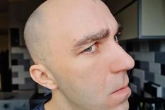 Durante años se creyó que solo las personas blancas se quedaban calvas y que eso las hacía superiores en comparación con los negros o los asiáticos. Foto: GETTY IMAGES