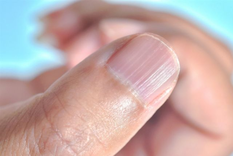 Cuidado, las uñas con rayas te están avisando cómo está tu organismo. Foto: Shutterstock