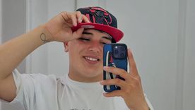 El ex GH sorprendió con fotos de cómo quedaron sus heridas. / @thi4go_km